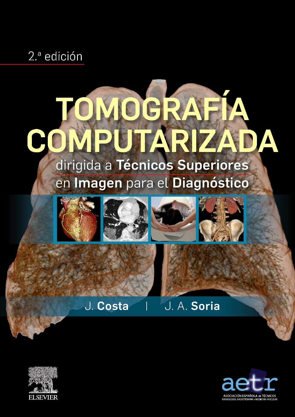 Tomografía Computarizada Dirigida a Técnicos Superiores en Imagen para el Diagnóstico | Marbán Libros S.L.