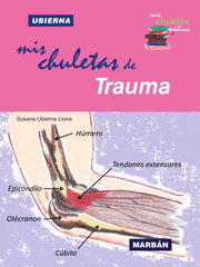 Mis chuletas (acordeones) de Trauma - Ubierna