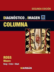 Ross - Columna | Marbán Libros