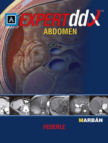Expert DDX Abdomen