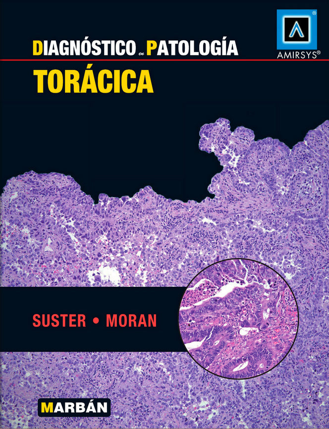Suster - Torácica | Marbán Libros