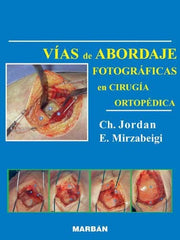 Vías de Abordaje Fotográficas en Cirugía Ortopédica