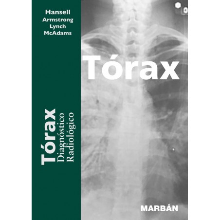 Hansell Formato "Premium" - Tórax Diagnóstico Radiológico