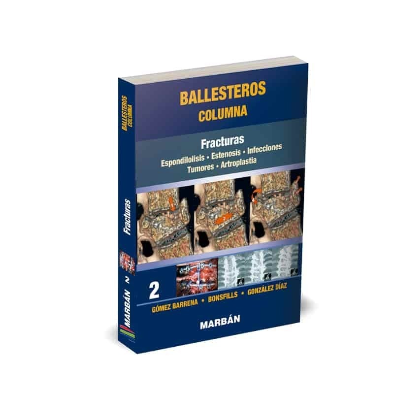 Ballesteros - Columna Tomo 2: Fracturas