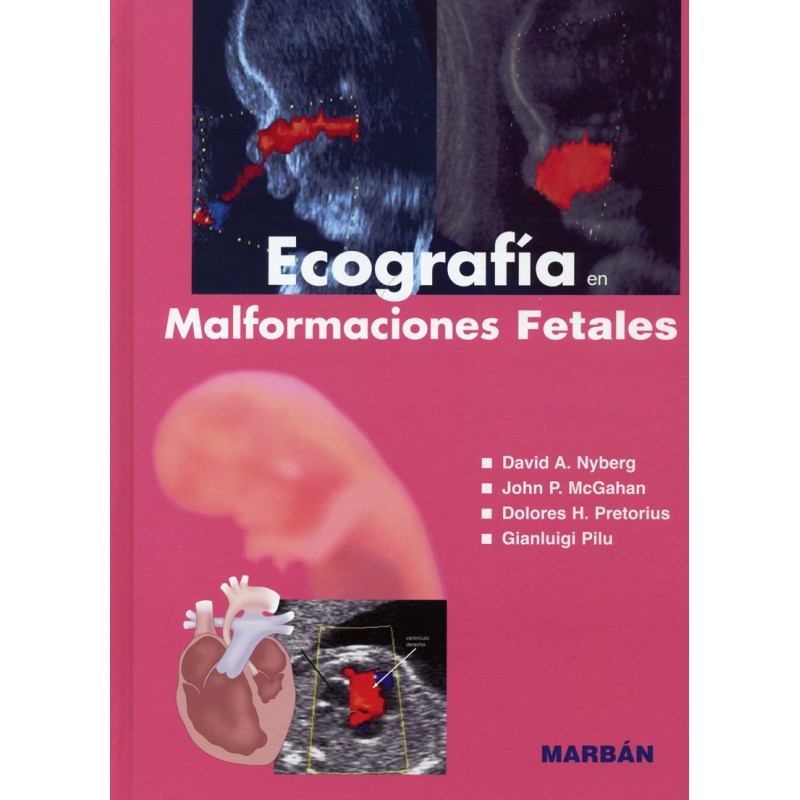 Ecografía En Malformaciones Fetales Marbán Internacional 6834