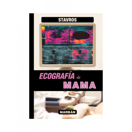 Ecografía de Mama - Stavros