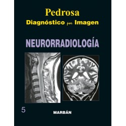 Pedrosa - Neurorradiología