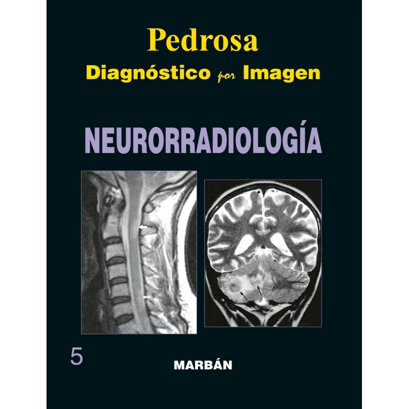 Pedrosa - Neurorradiología