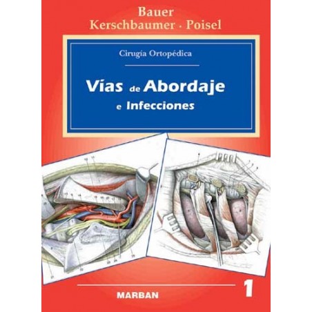 Bauer  /  Vías de Abordaje e Infecciones - Cirugía Ortopédica. Vol 1 