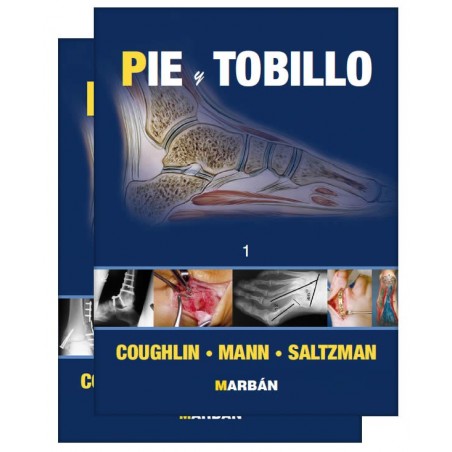 Coughlin . Mann . Saltzman /  Edición Premium - Cirugía de Pie y Tobillo 2 Vols. 