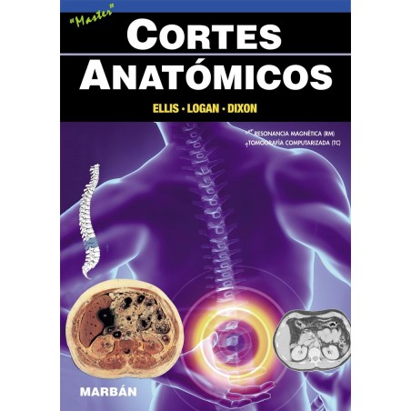 Ellis  - Cortes Anatómicos