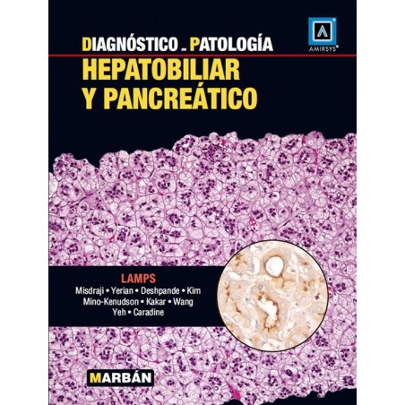 Lamps - Hepatobiliar y Pancreático