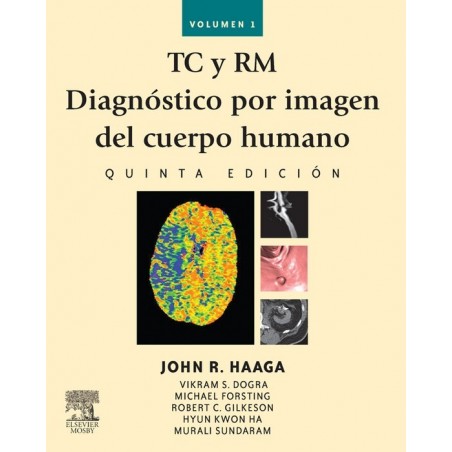 Haaga - TC y RM Diagnóstico por imagen del cuerpo humano, 2 Vol, 5ª Ed.