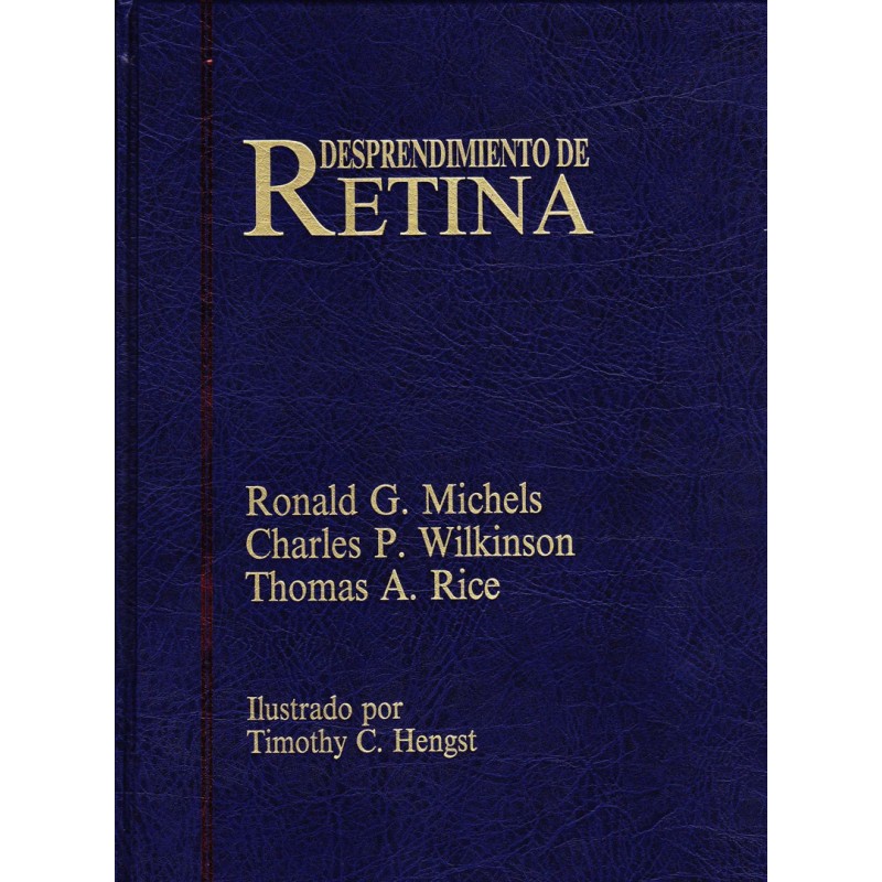 Michels - Desprendimiento de Retina, 1ª Ed