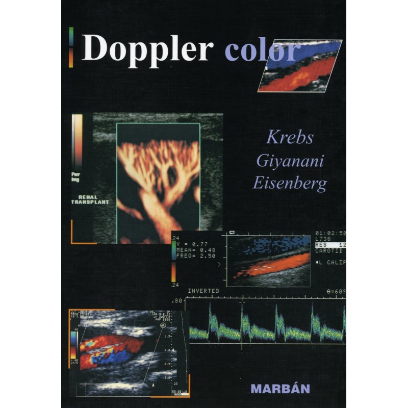 Krebs . Giyanani . Eisenberg - Doppler Color