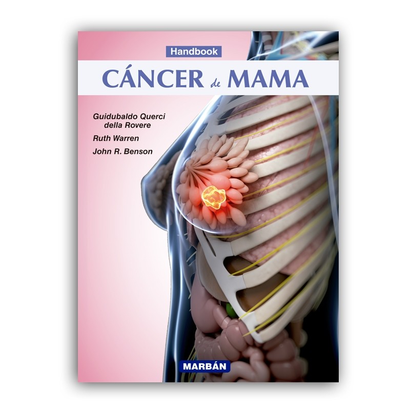 Querci della Rovere / Formato "Handbook" - Cáncer de Mama