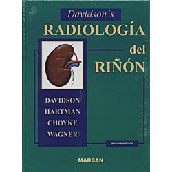 Davidson´s Radiología del Riñón