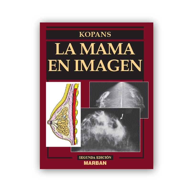 Kopans - La mama en imagen