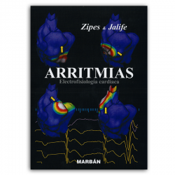 Arritmias - Zipes