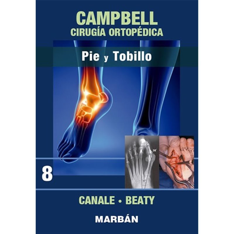 Campbell Cirugia Ortopédica Pack 8 Volúmenes Flexilibro 8498