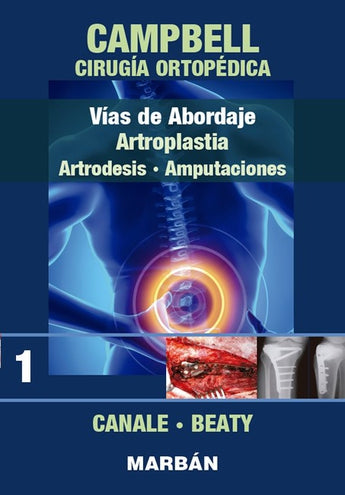 Cirugía Ortopédica - Vías de abordaje, Artroplastia, Artrodesis, Amputaciones