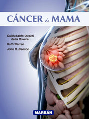 Cáncer de mama