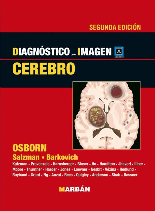 Cerebro - Osborn