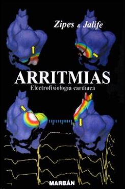 Arritmias Electrofisiología cardíaca