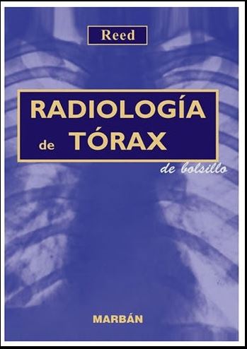 Radiología de tórax - Handbook