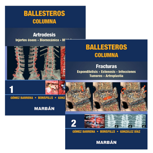 Columna 2 Vols. Flex - Ballesteros