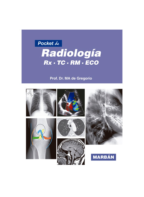 Pocket de Radiología. RX, TC, RM, ECO