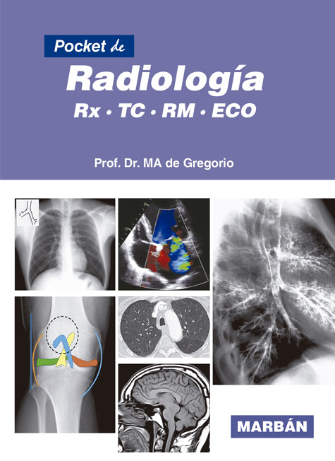 Pocket de Radiología. RX, TC, RM, ECO