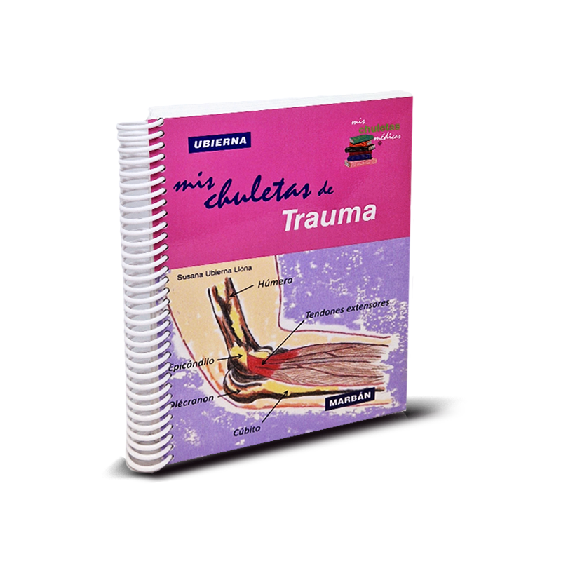 Mis chuletas (acordeones) de Trauma - Ubierna