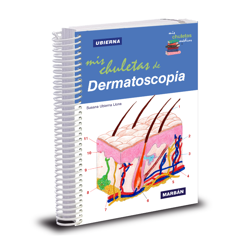 Mis Chuletas de Dermatoscopia - Ubierna - HB