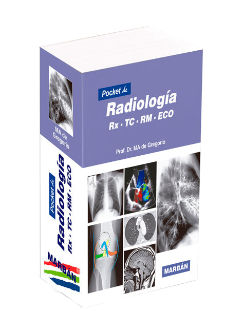 Pocket de Radiología. RX, TC, RM, ECO