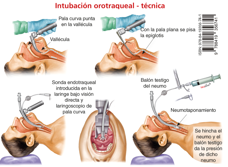 Dosis de Fármacos en Emergencias