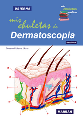 Mis Chuletas de Dermatoscopia - Ubierna - HB