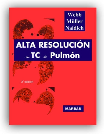 Alta Resolución en TC de Pulmón