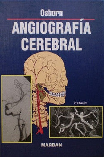 Angiografía Cerebral - Osborn