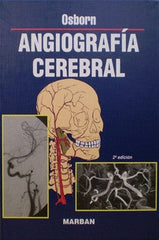 Angiografía Cerebral - Osborn