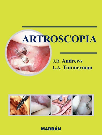 Artroscopia