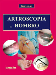 Artroscopia de Hombro