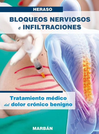 Bloqueos Nerviosos e Infiltraciones - Premium flex