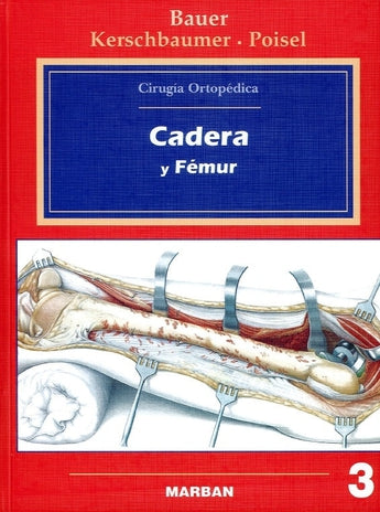 Bauer - Cirugía Ortopédica - Cadera y Fémur  Vol. 3