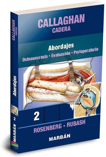 Callaghan Cadera Vol. 2     Abordajes . Osteonecrosis . Evaluación . Perioperatorio.