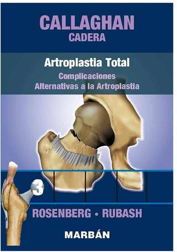 Callaghan  Cadera Vol. 3   Artroplastia Total. Complicaciones. Alternativas a la Artroplastia