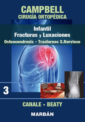 Cirugía Ortopédica - Infantil, Fracturas y Luxaciones, Osteocondrosis, Trastornos S.Nervioso. 