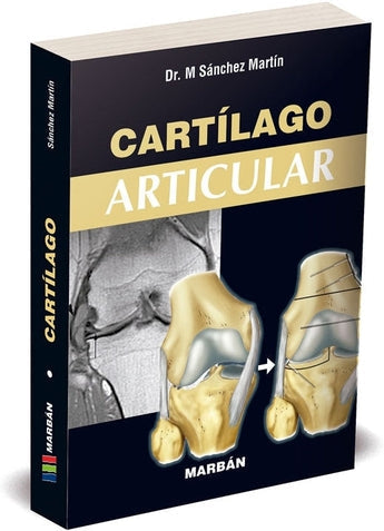 Cartílago Articular