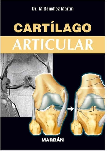 Cartílago Articular