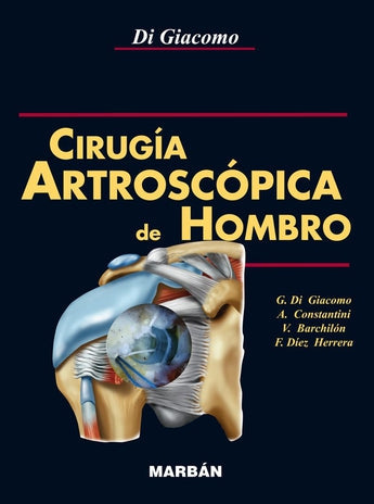 Cirugía Artroscópica del Hombro